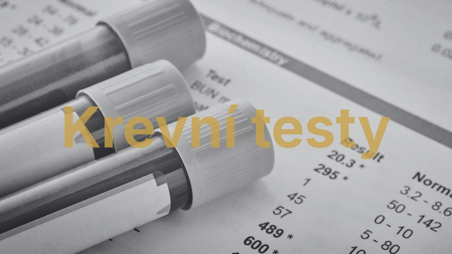 Jak zjistit nedostatek vitamínů a minerálů? Odpověď najdete v krevních testech - Axioniq labs